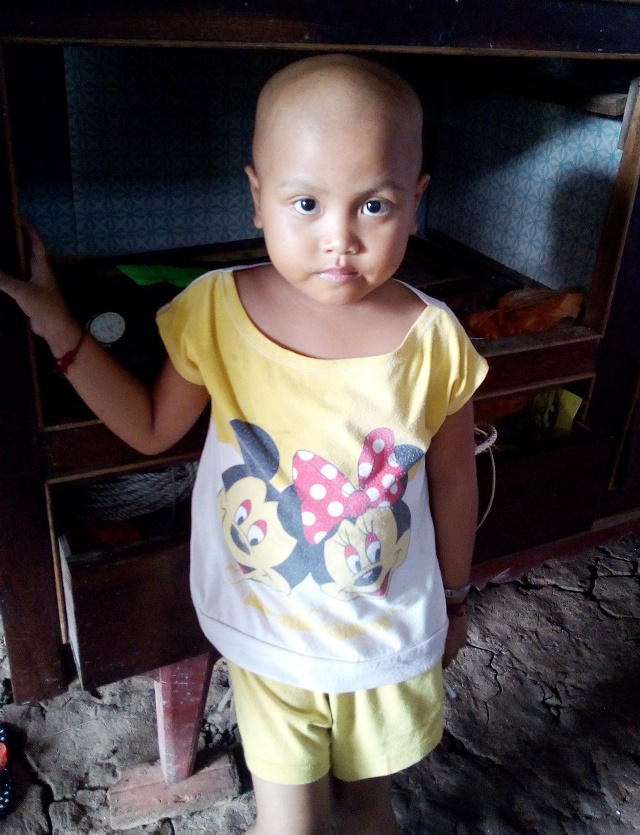 Ám ảnh ánh mắt của bé 5 tuổi người dân tộc Khmer bị ung thư máu